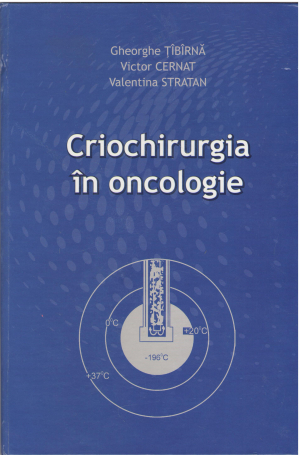 Criochirurgia in oncologie  regiunea capului si gatului (med1)