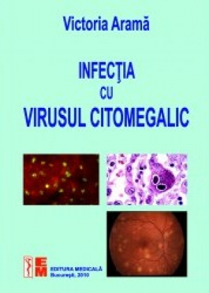 Infecţia cu virusul citomegalic