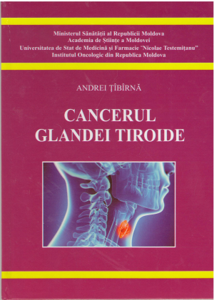 cancerul glandei tiroide (med2)