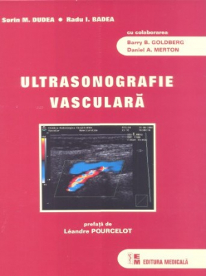 Ultrasonografie vasculară