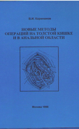 Новые методы операций на толстой кишке и в аналъной области