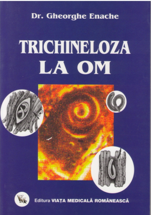 Trichineloza la om