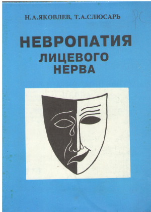 Невропатия лицевого нерва