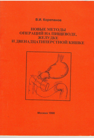 Новые методы операций на пищеводе, желудке и двенадцатипертной кишке