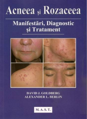 Acneea si rozaceea . Manifestari , diagnostic si tratament