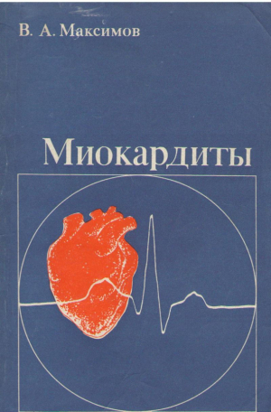 Миокардиты