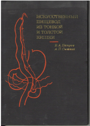 Искусственныи пищевод из тонкой и толстои кишки