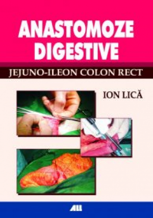 Anastomoze digestive