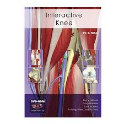 Interactive Knee DVD